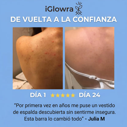Barra Anti-Acne