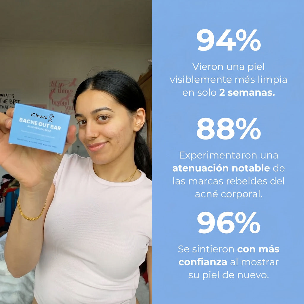 Barra Anti-Acne